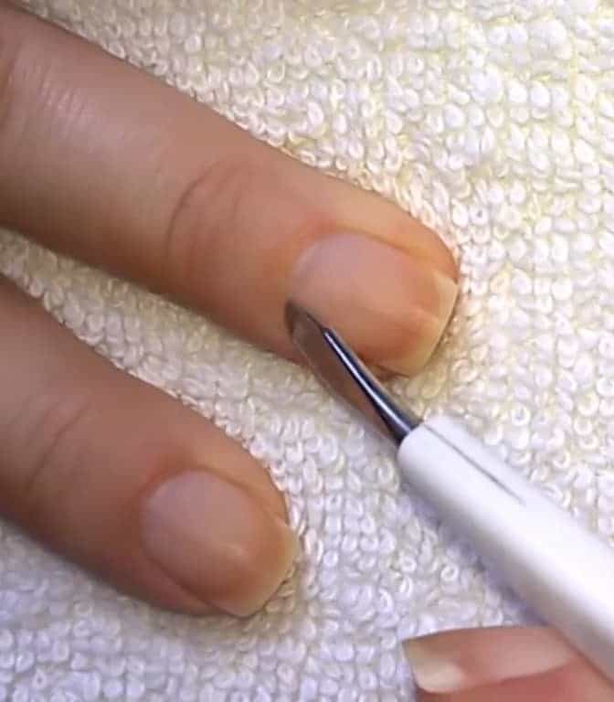 remove cuticle