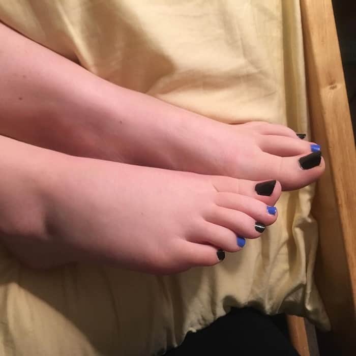 black and blue toe nails 