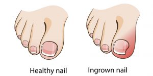 Nail length: Short.