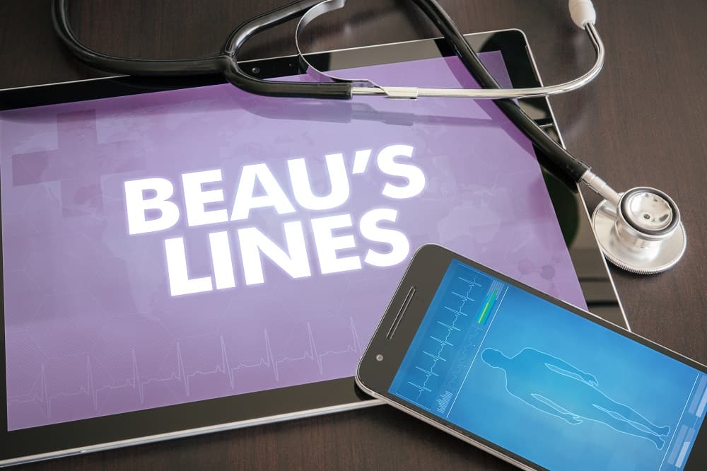 Are Beau's Lines Dangerous?