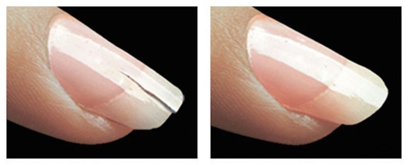 fingernail splitting