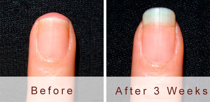 Biotin Intake for Nails: Good or Bad Idea? – NailDesignCode