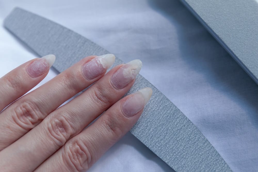 Can Acrylic Nails Damage Fingers or Nails?