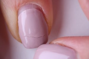 How To Fix Cracked or Broken Acrylic Nails at Home (Emergency Guide)
