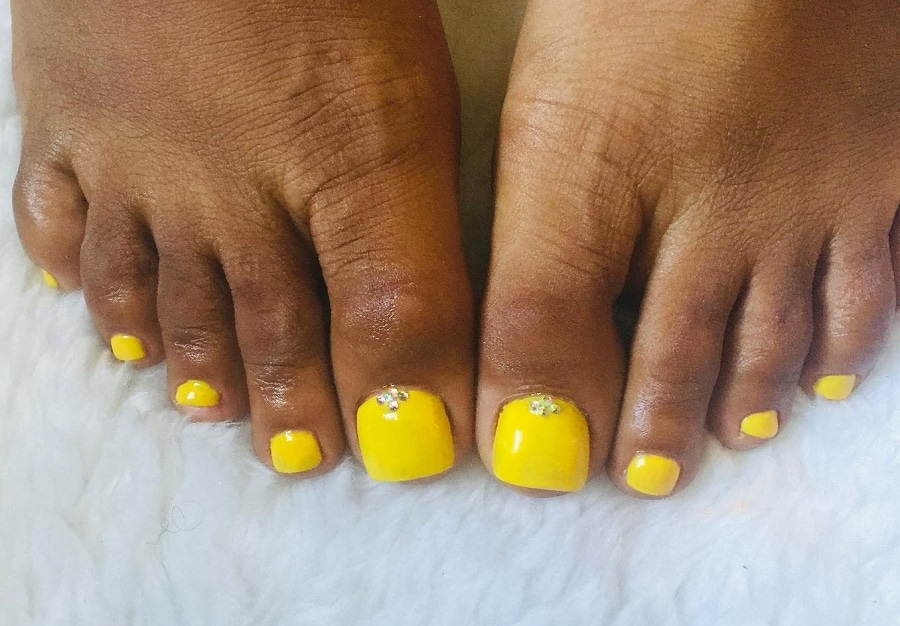 yellow toenails on dark skin