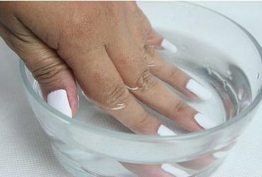 Spoon Nails (Koilonychia): Causes, Symptoms & Treatment